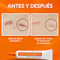 Strataderm Gel Tratamiento Profesional De Cicatrices 5g - Miniatura 8
