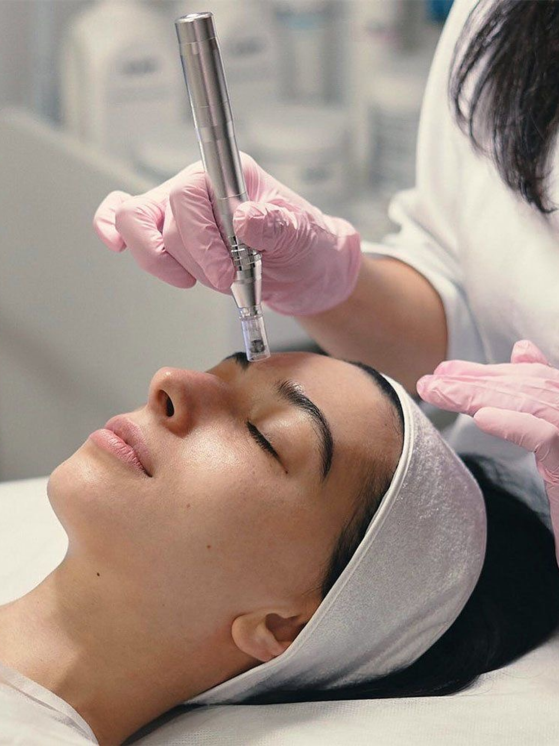 Limpieza Facial + PDRN + Microneedling 1