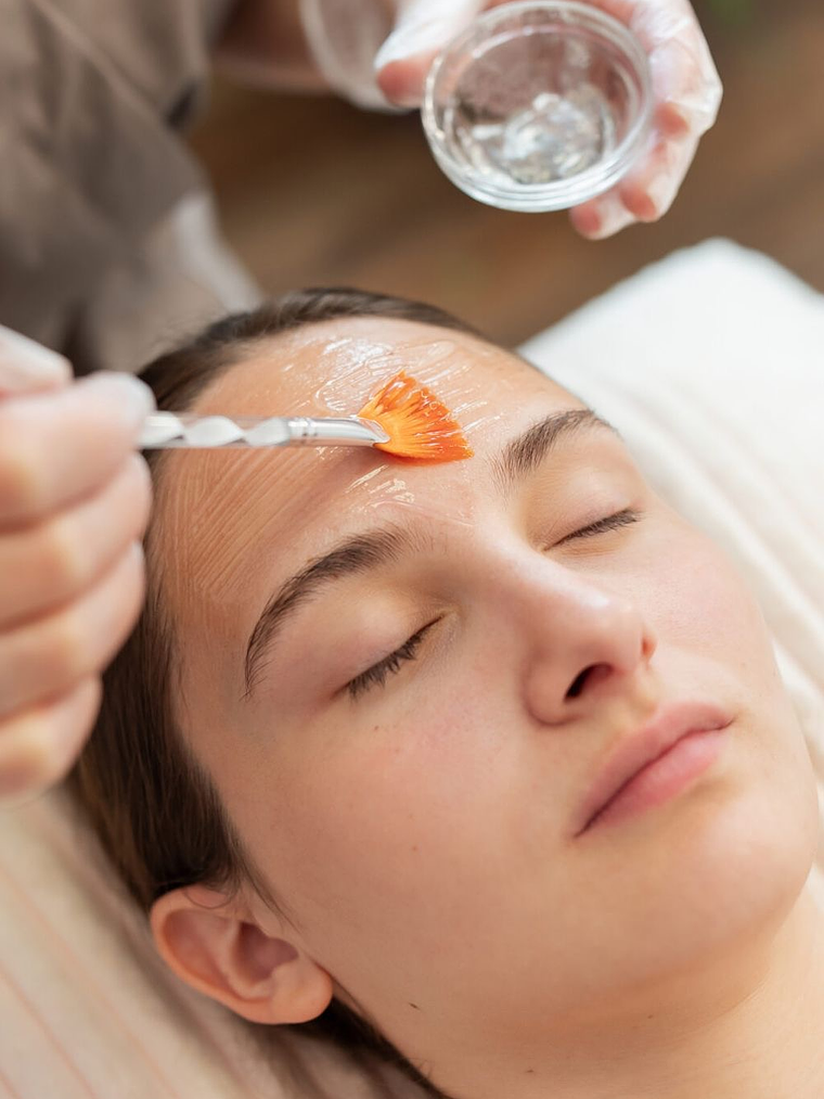 Peeling Acné Paquete 5 sesiones 1