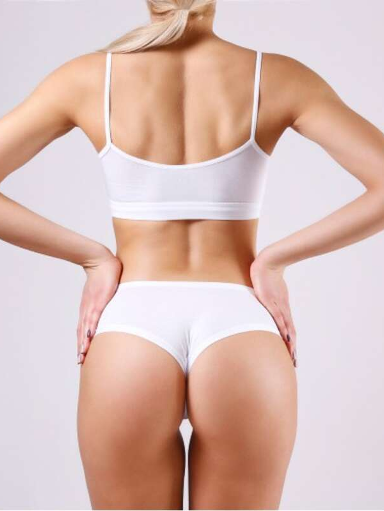 Peeling Químico Glúteos 1