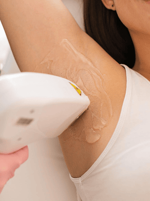 Depilación Láser Axilas