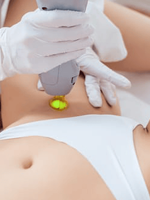 Depilación Láser Brasilero