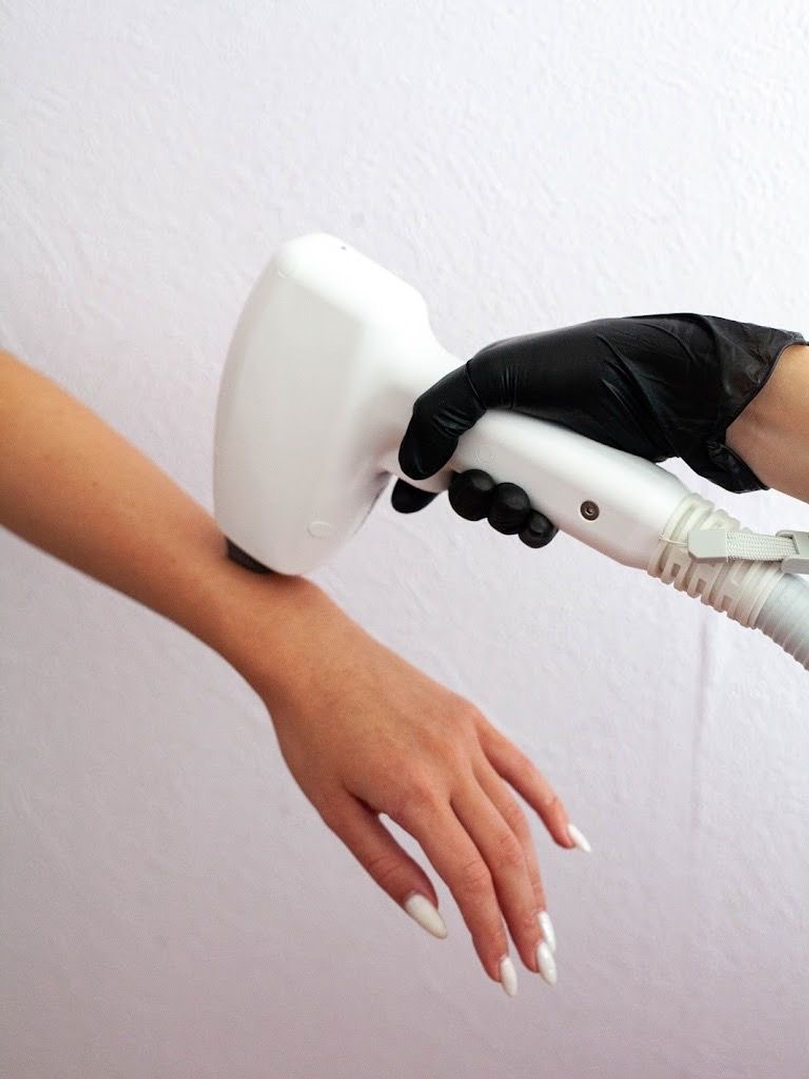 Depilación Láser Brazos Completos 1