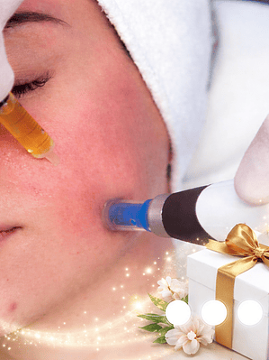 PDRN con Microneedling – Paquete 3 Sesiones