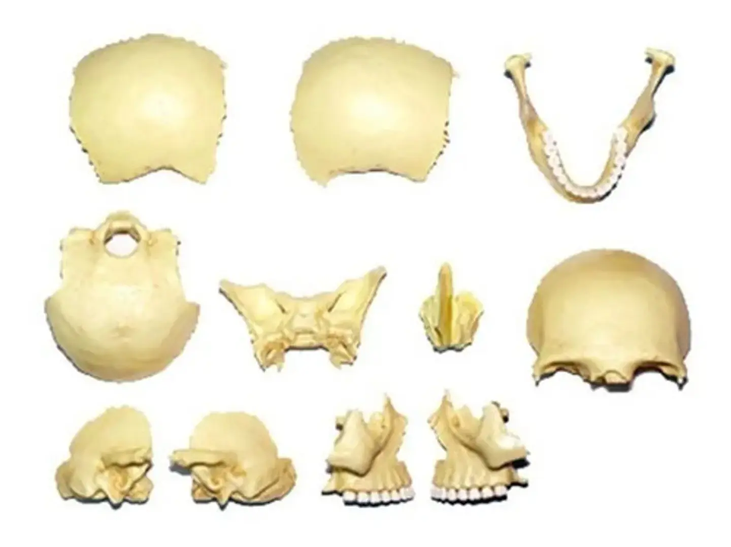 4d Vision Human Anatomy Modelo Craneo Humano 17pcs 26086 4