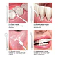 Irrigador Dental Portátil Profesional - Miniatura 5