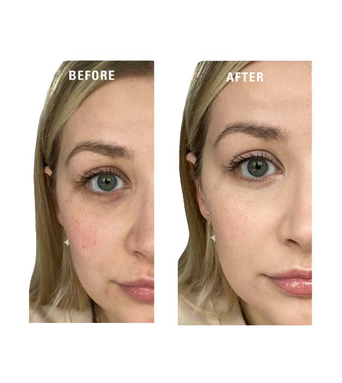 Revolution - Primer Superbase Colour Correcting - Yellow 4