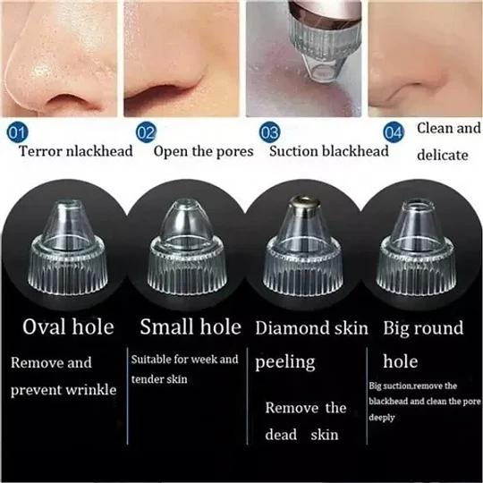 Removedor Extractor Puntos Negros Espinillas Limpieza Facial
