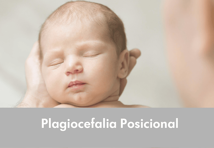 Plagiocefalia Posicional 