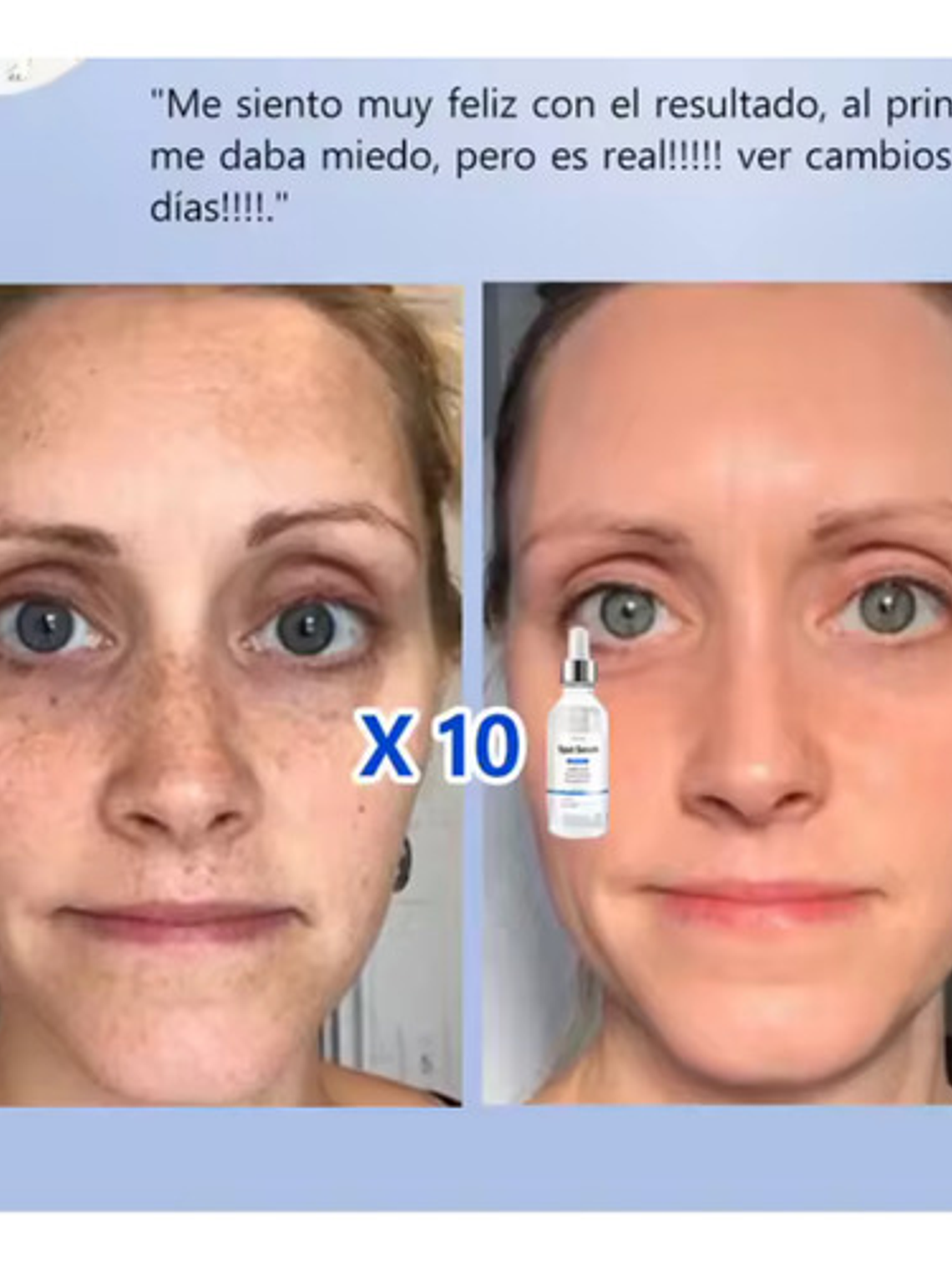 Serum Anti Manchas, Vitamina C + Nicotinamida, Frasco 30ml 4