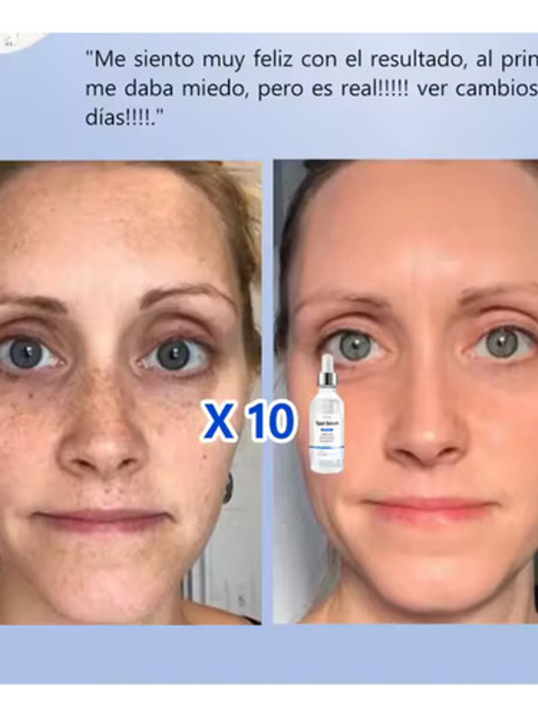 Serum Anti Manchas, Vitamina C + Nicotinamida, Frasco 30ml 4