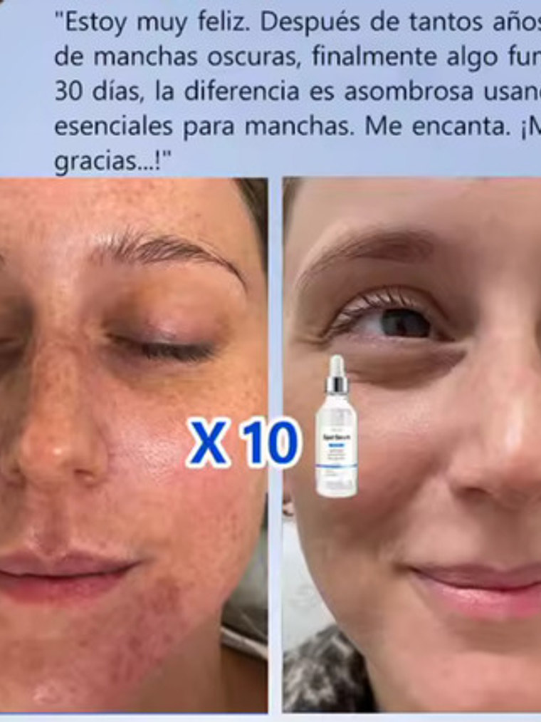 Serum Anti Manchas, Vitamina C + Nicotinamida, Frasco 30ml 5