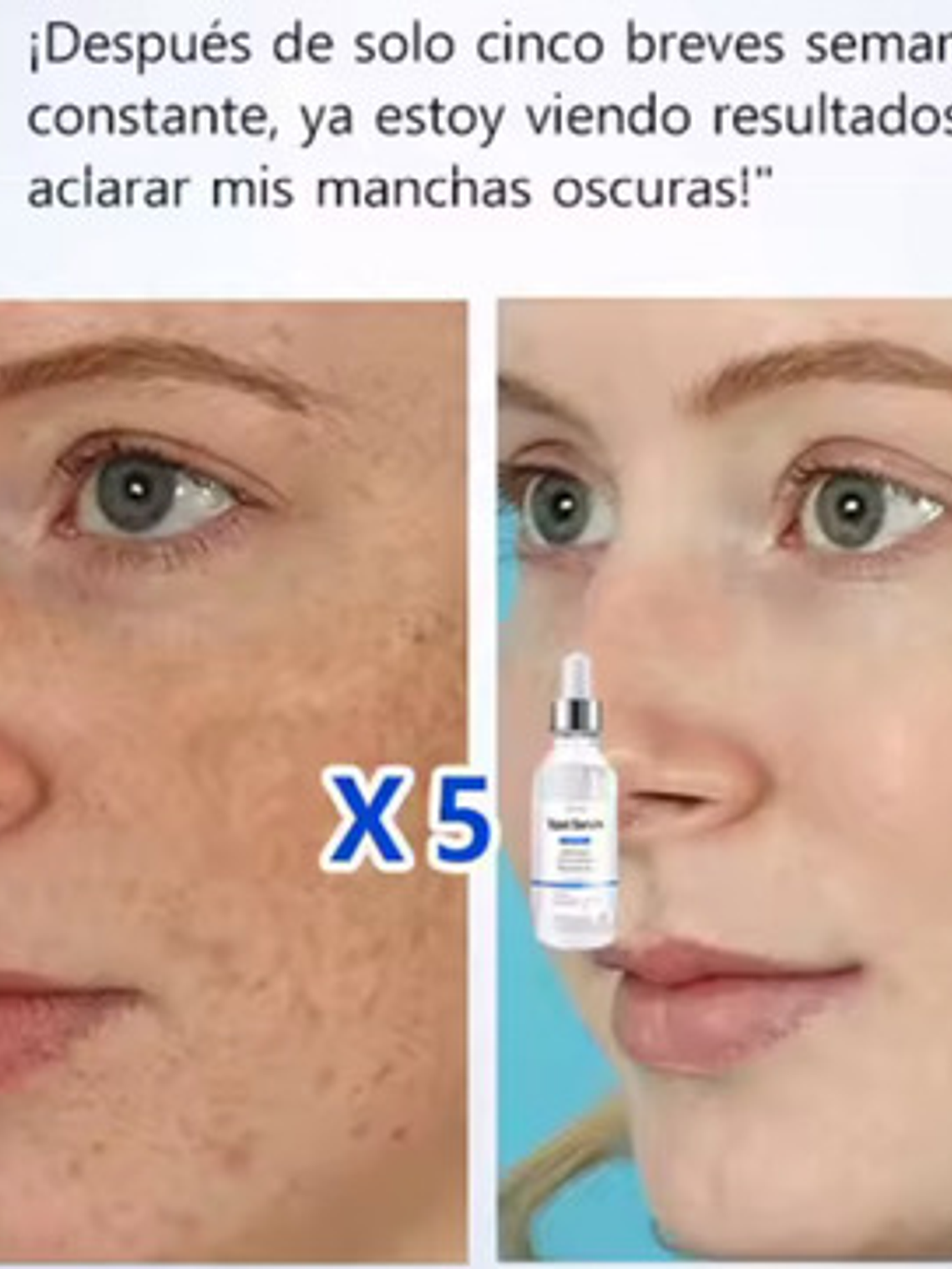 Serum Anti Manchas, Vitamina C + Nicotinamida, Frasco 30ml 6