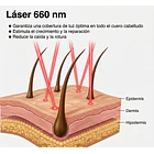Venus Vita-X: Casco Láser (LLLT) fortalece el folículo desde la raíz. 3