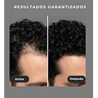 Venus Vita-X: Casco Láser (LLLT) fortalece el folículo desde la raíz. 6