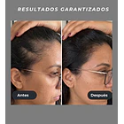 Venus Vita-X: Casco Láser (LLLT) fortalece el folículo desde la raíz. 7