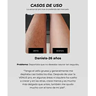 Depiladora Láser Venus IPL PRO MAX: resultados en 8 semanas  7