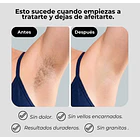 Depiladora Láser Venus IPL PRO MAX: resultados en 8 semanas  3