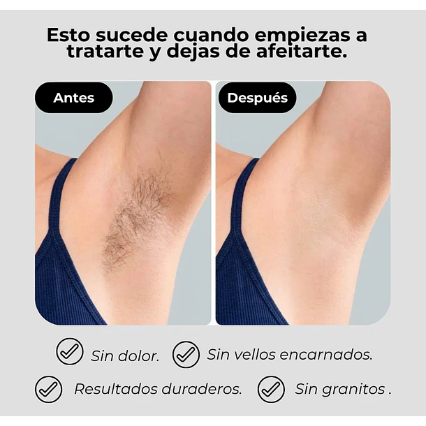 Depiladora Láser Venus IPL PRO MAX: resultados en 8 semanas  3