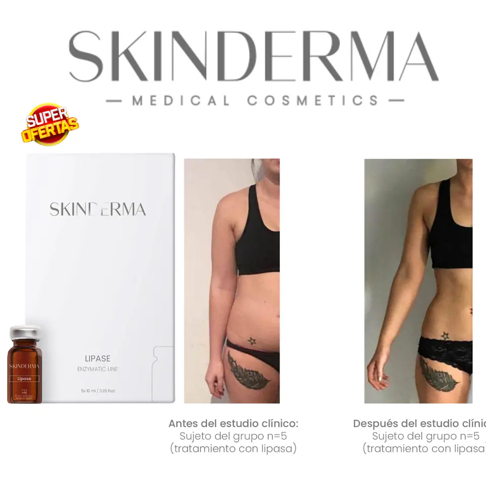 1 VIAL 10 ML LIPASA 500 UI 2