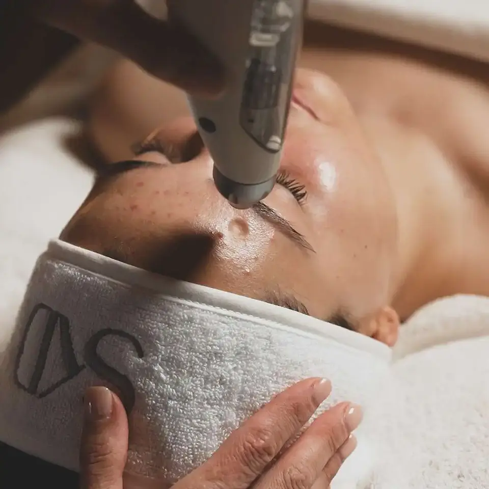 1 VIAL 10ML EXOSOMAS Whitening Liofilizado 1500 UI 8