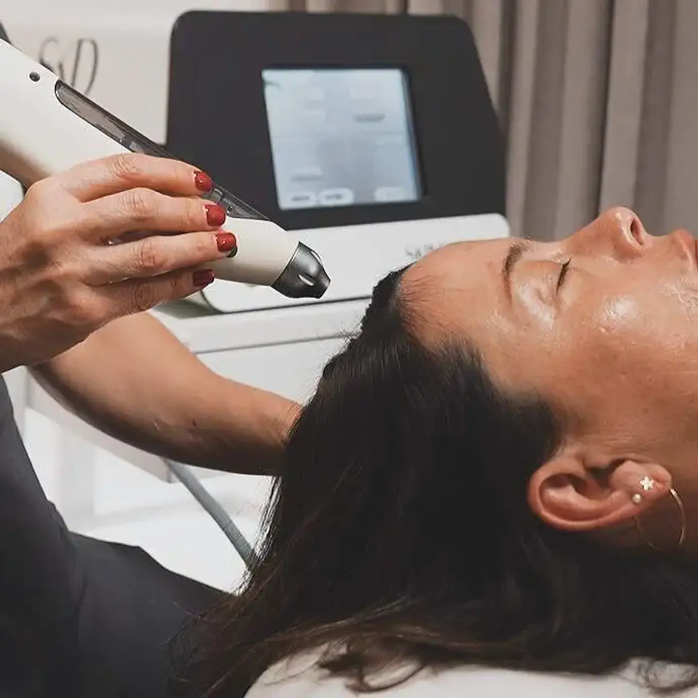 1 VIAL 10ML EXOSOMAS HAIR Liofilizado 1500 UI 8