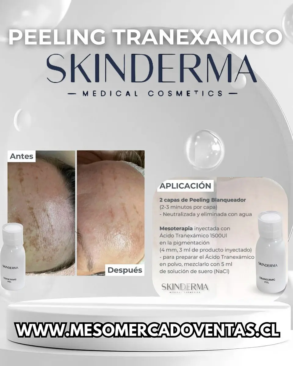 Peeling Tranexamic  100 ml 1