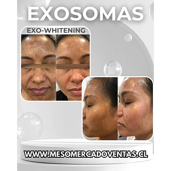 1 VIAL 10ML EXOSOMAS Whitening Liofilizado 1500 UI