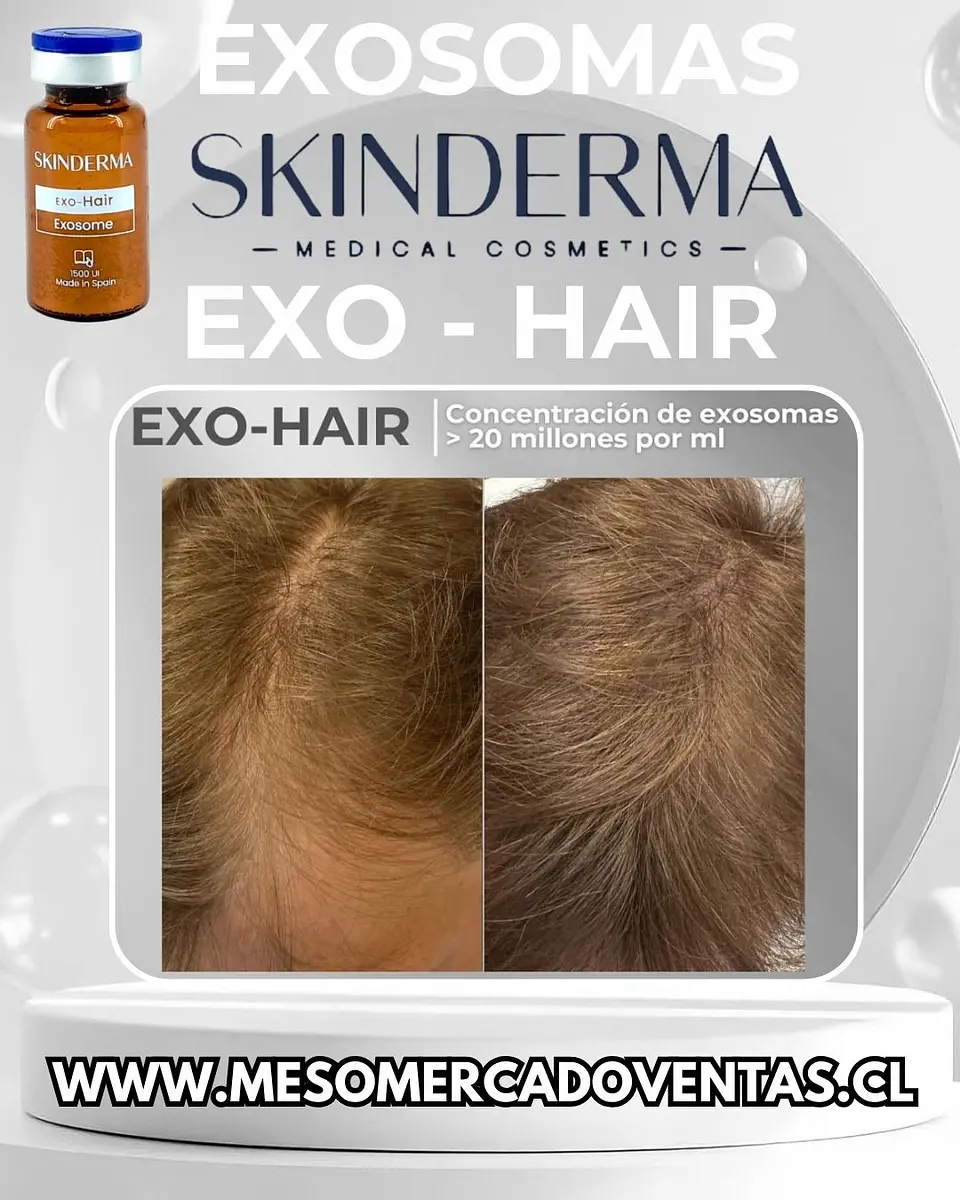 1 VIAL 10ML EXOSOMAS HAIR Liofilizado 1500 UI 4
