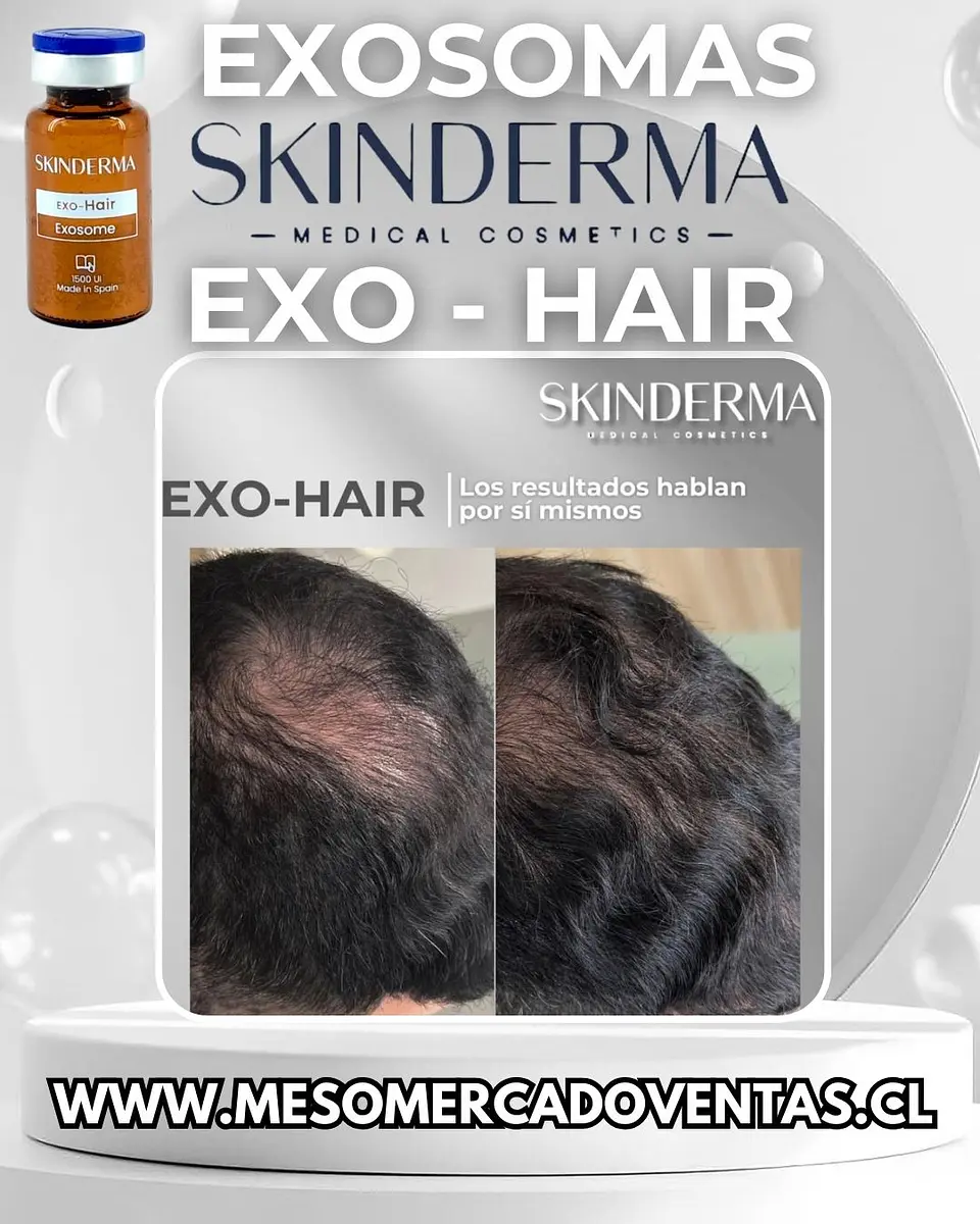 1 VIAL 10ML EXOSOMAS HAIR Liofilizado 1500 UI 5