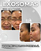 Exosomes Whitening LIOFILIZADO  5 VIAL 10 ML  1500UI Reconstituir  - Miniatura 2