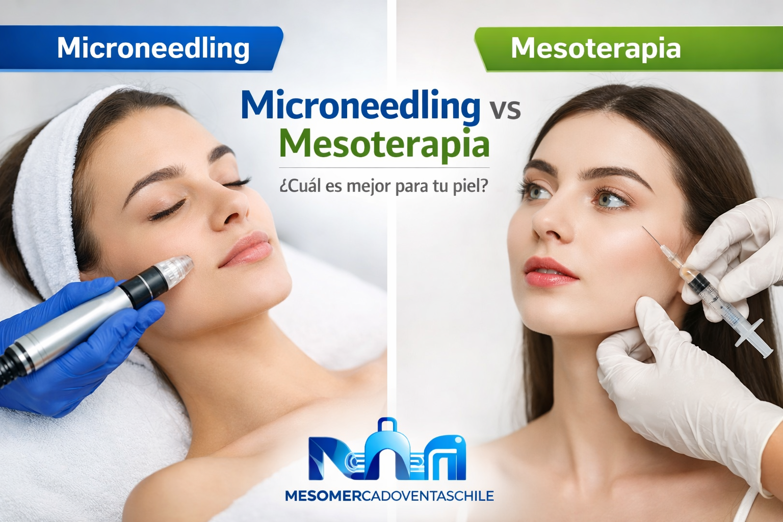 Microneedling vs Mesoterapia: ¿Cuál es mejor para tu piel?
