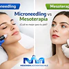 Microneedling vs Mesoterapia: ¿Cuál es mejor para tu piel?