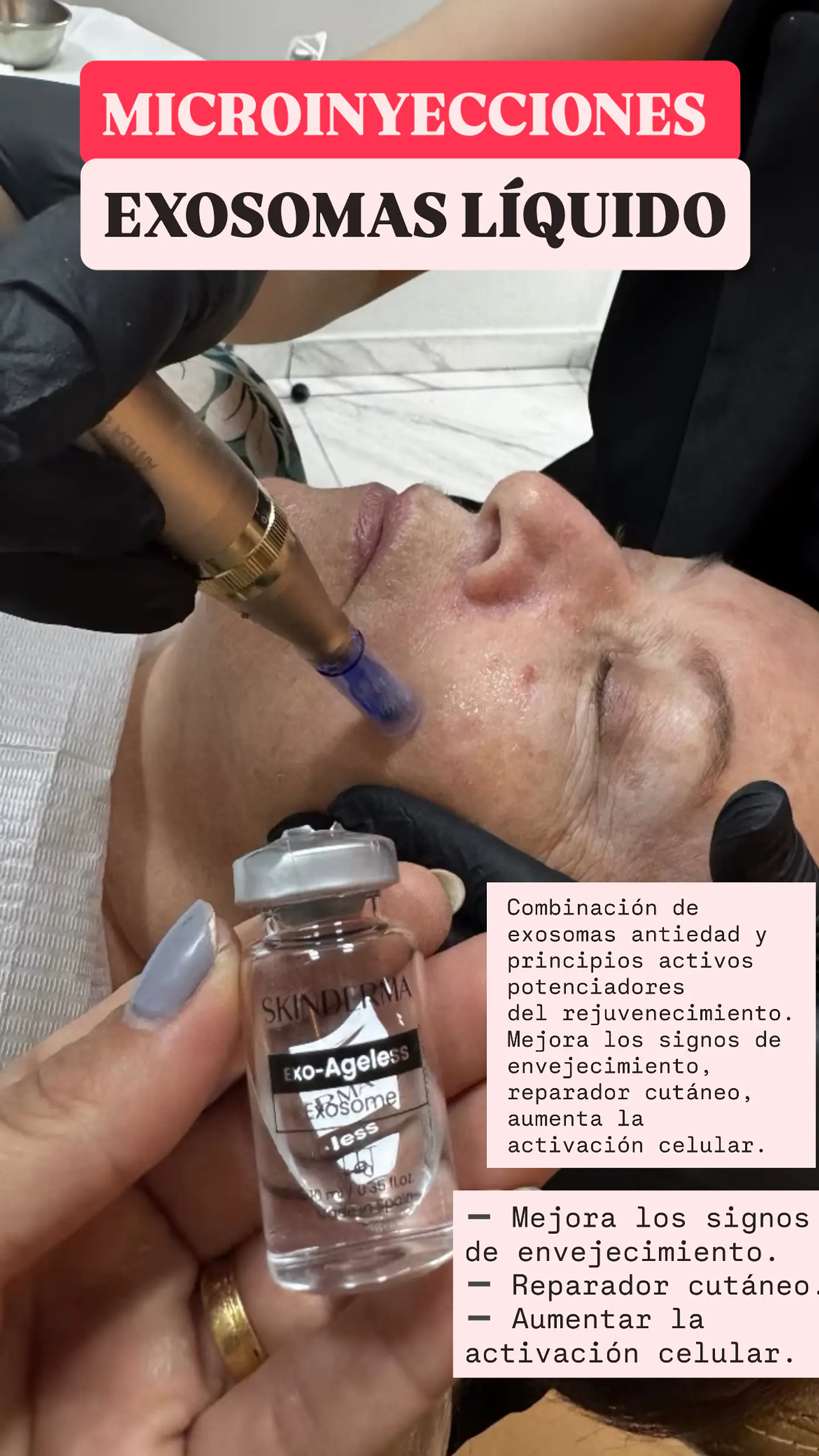 CAJA 5 VIALES 10ML EXOSOMAS Ageless Liquido 3