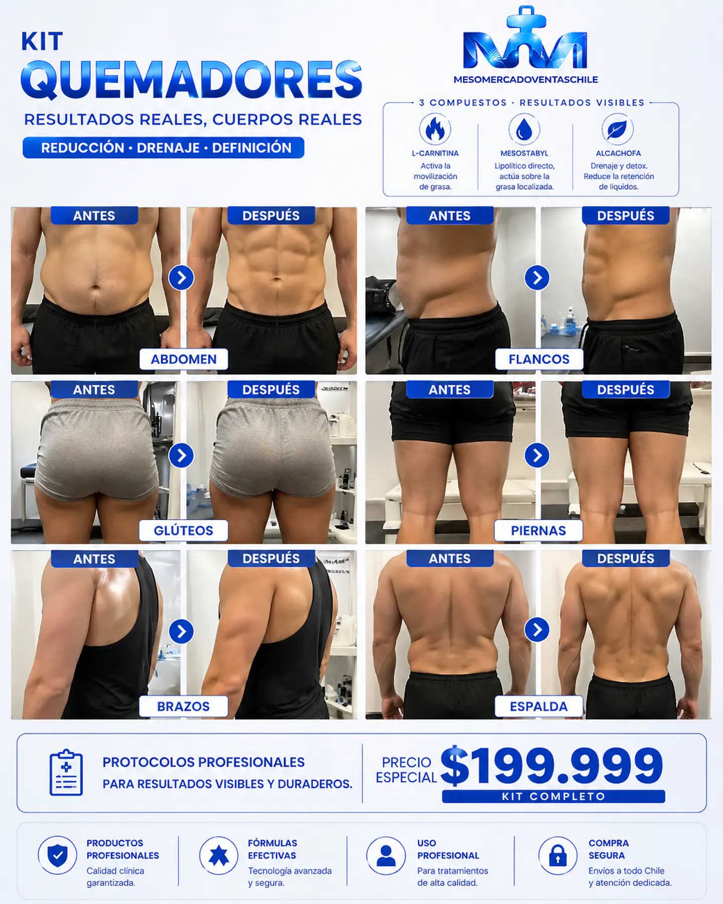 KIT 30 AMP QUEMADORES MESOSTABYL-LCARNITINA-ALCACHOFA MESOESTETIC  2