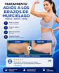 Tratamiento Adiós a los Brazos de murcielago - Miniatura 1