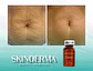 1 VIAL 10ML  N-ZYMES I 1500 UI LIOFILIZADO   - Miniatura 5