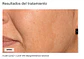 CAJA 5 VIALES X 5ML  C.PROF 210  DESPIGMENTATION SOLUCION ( efecto iluminador y antioxidante. Unifica el tono de piel.) - Miniatura 3