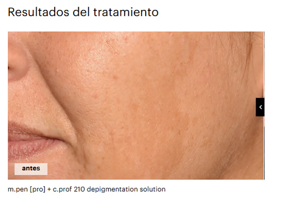 CAJA 5 VIALES X 5ML  C.PROF 210  DESPIGMENTATION SOLUCION ( efecto iluminador y antioxidante. Unifica el tono de piel.) 3