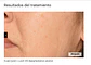 CAJA 5 VIALES X 5ML  C.PROF 210  DESPIGMENTATION SOLUCION ( efecto iluminador y antioxidante. Unifica el tono de piel.) - Miniatura 4