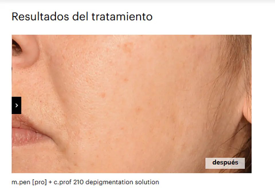 CAJA 5 VIALES X 5ML  C.PROF 210  DESPIGMENTATION SOLUCION ( efecto iluminador y antioxidante. Unifica el tono de piel.) 4
