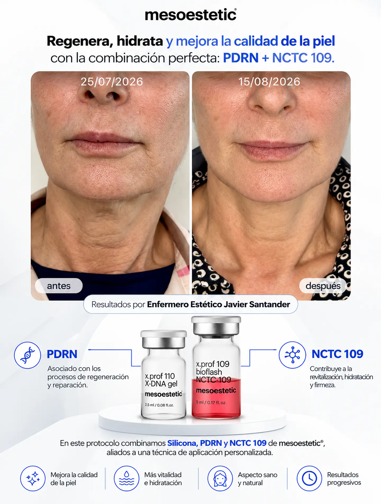 CAJA 5 vial 5ML  BIOFLASH NCTC + CAJA 5 vial 2,5ML  X-DNA: BIOREVITALIZACIÓN EN DOBLE ACCIÓN 7