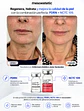 CAJA 5 vial 5ML  BIOFLASH NCTC + CAJA 5 vial 2,5ML  X-DNA: BIOREVITALIZACIÓN EN DOBLE ACCIÓN - Miniatura 7