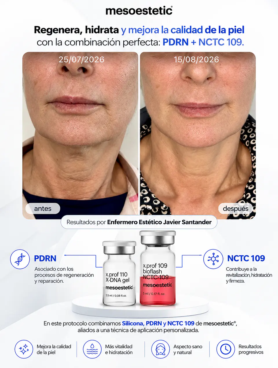 CAJA 5 vial 5ML  BIOFLASH NCTC + CAJA 5 vial 2,5ML  X-DNA: BIOREVITALIZACIÓN EN DOBLE ACCIÓN 7