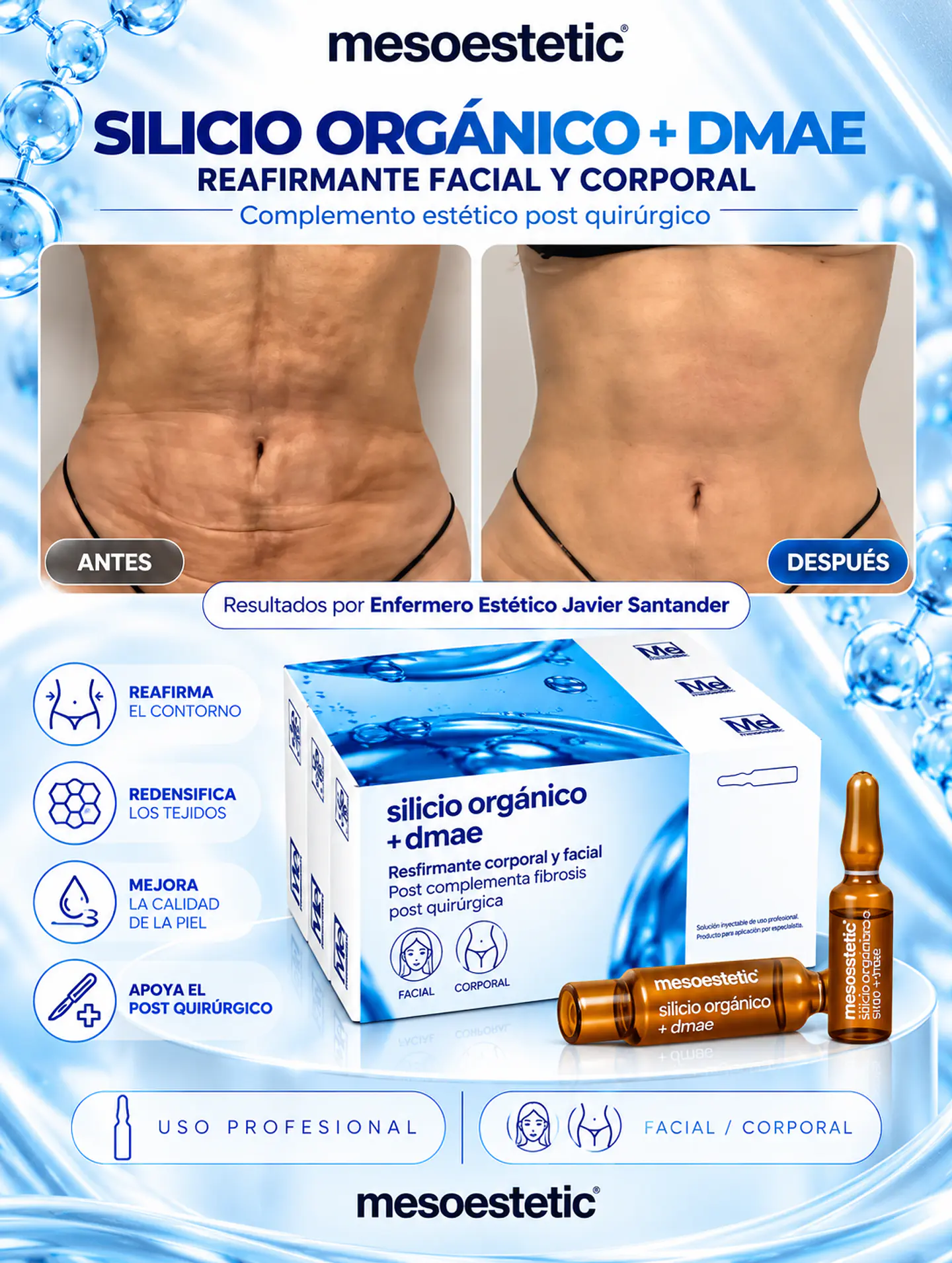 POST LIPO REDUCE Y REAFIRMA 10  amp silicio y 10 Dmae Mesoestetic  10