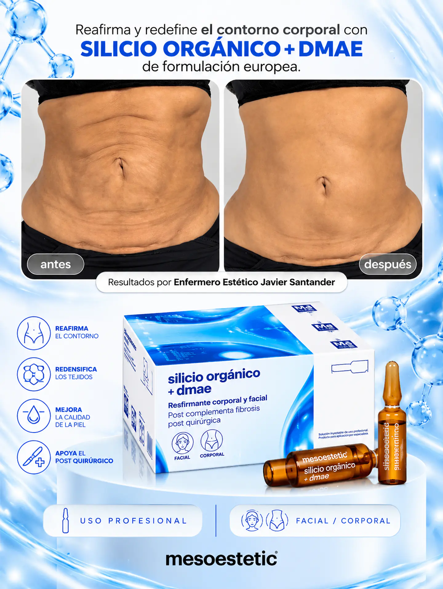 POST LIPO REDUCE Y REAFIRMA 10  amp silicio y 10 Dmae Mesoestetic  8