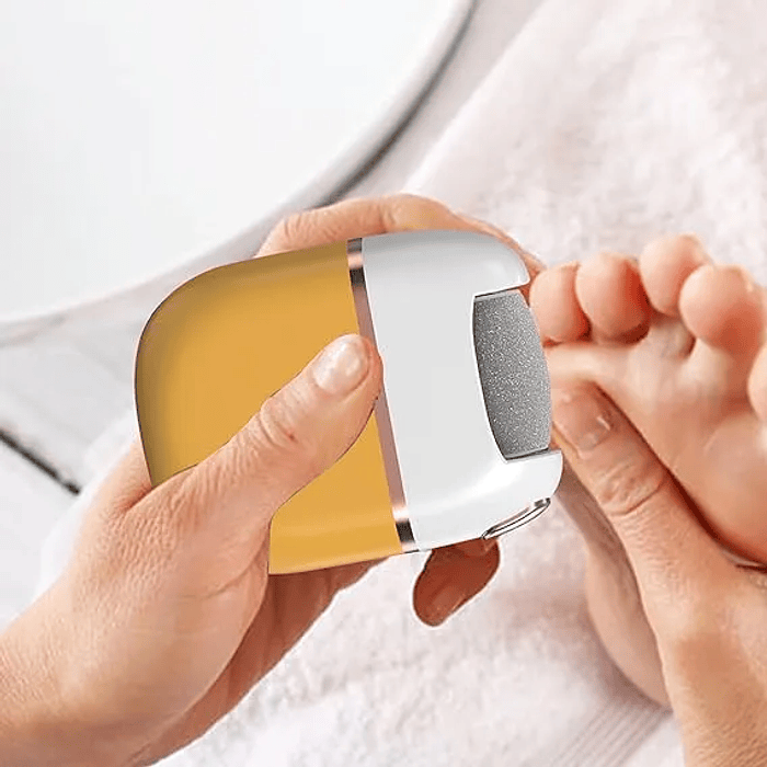 REMOVEDOR DE CALLOS INALAMBNRICO 1