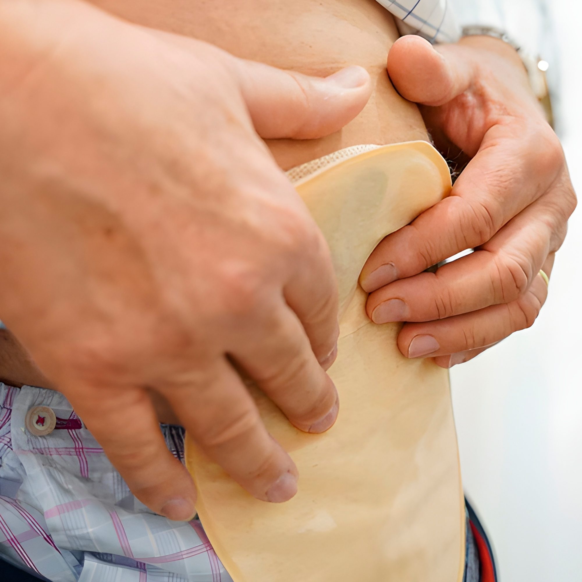 Set 10 Bolsas Colostomía Filtro Drenable Anti Olor Y Gases 8