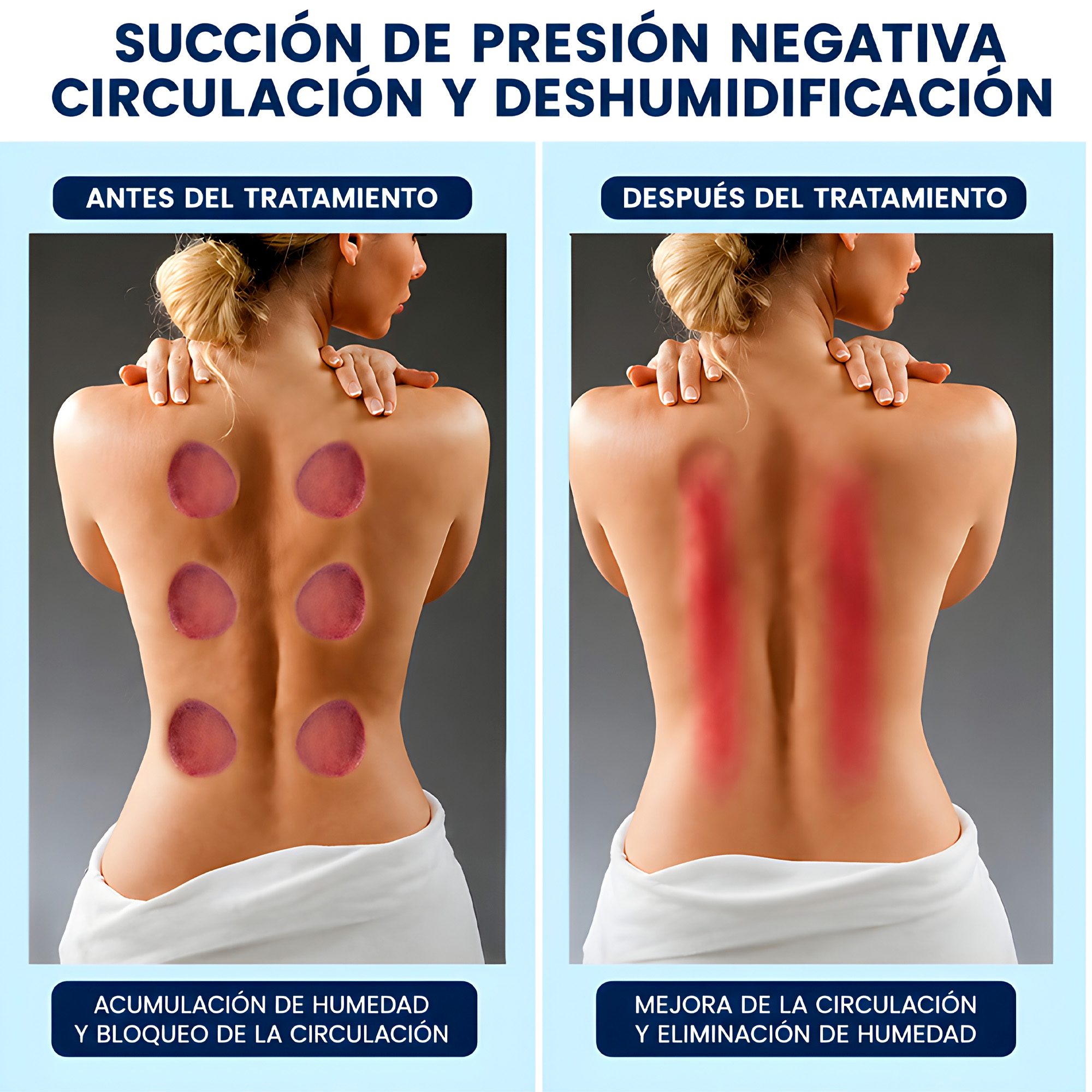 Masajeador Ventosas Anti Celulitis Reductor Cuerpo Eléctrico 5