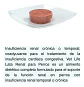 Vet Life Pack 3 Latas Vetlife - Renal Para Perros - Total 900 Gr. - Miniatura 2